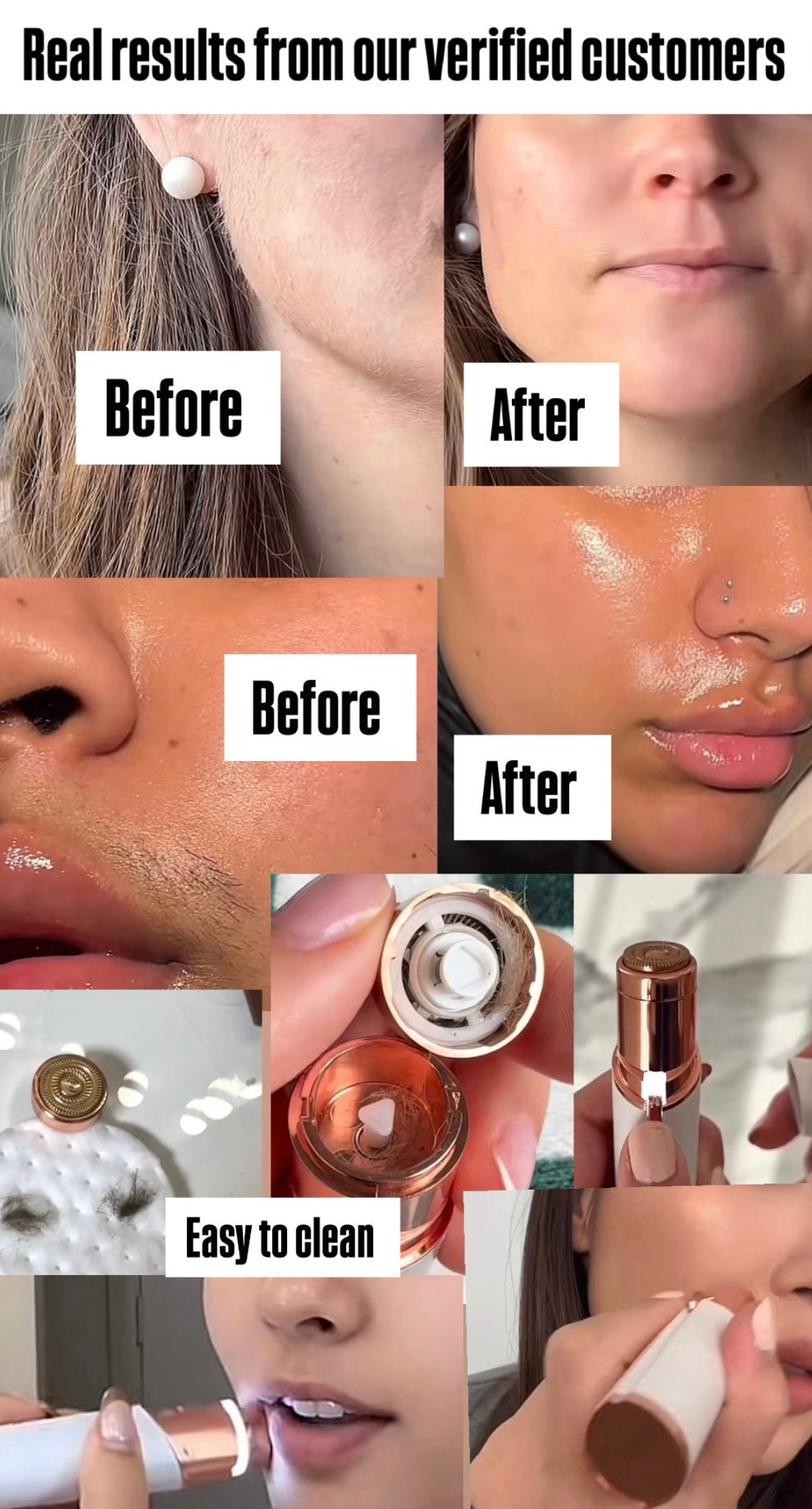 ELITE BLOOM™ Smart Portable Hair Removal Device – For Smooth, Radiant Skin